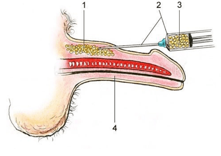 lipophilisant pour augmenter un membre
