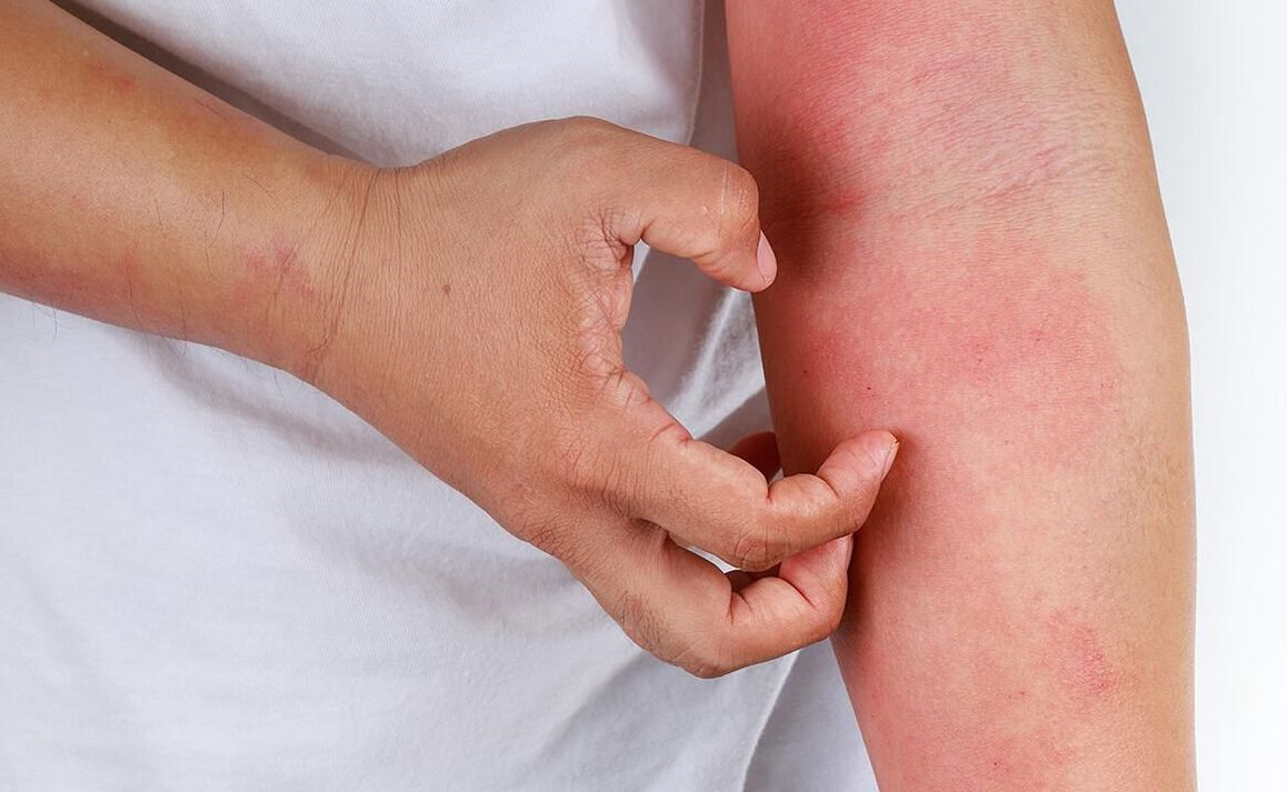 complications possibles liées à la consommation de boissons gazeuses