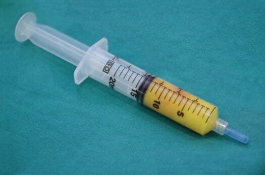 Seringue à tissu adipeux pour lipofilling