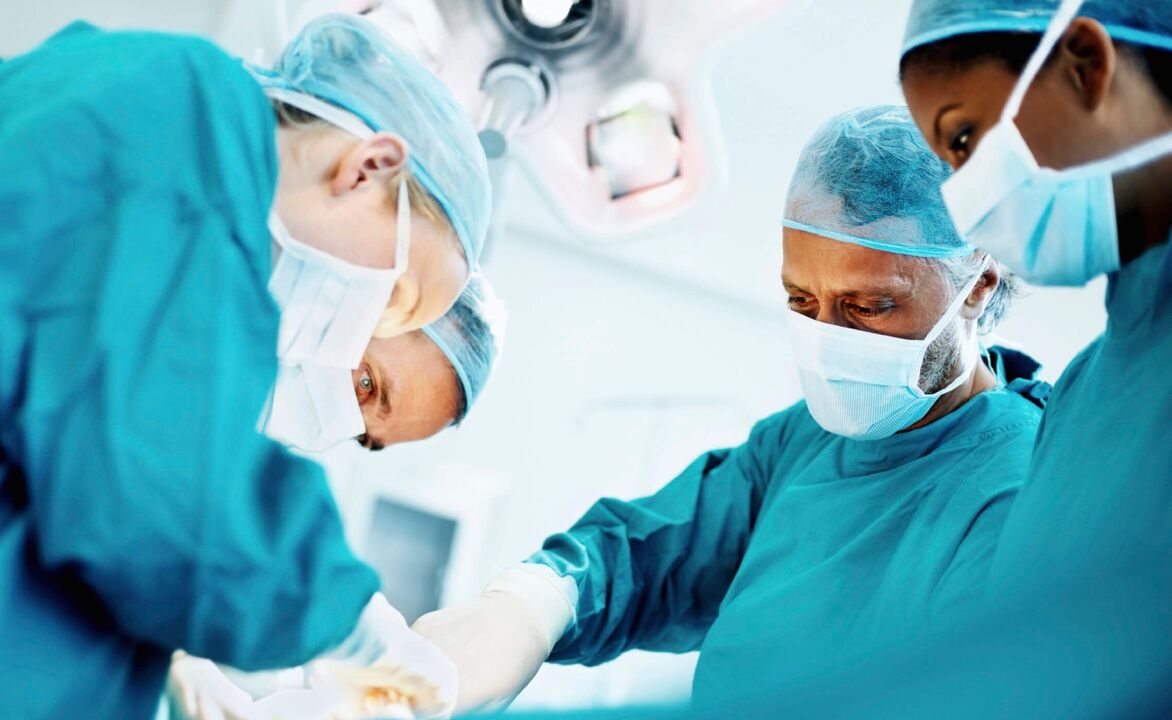 Le processus d’agrandissement du pénis par les chirurgiens par chirurgie.